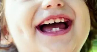 兒童牙病問題