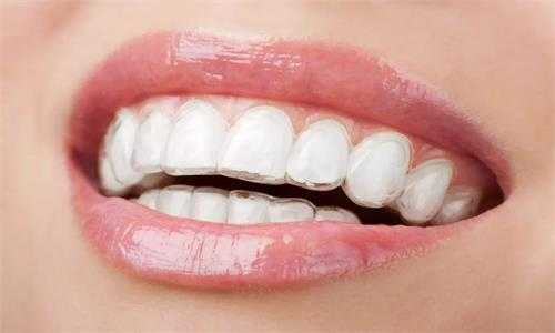 拔牙具體有哪些禁忌？