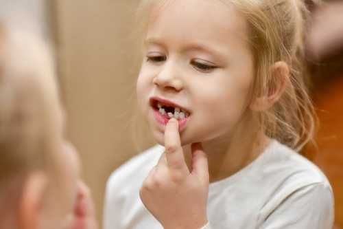 牙釉質發育不全如何預防？