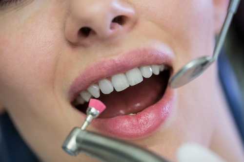 怎樣保護牙齒？
