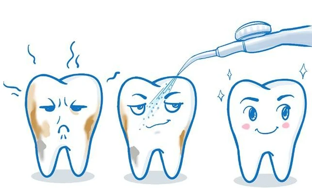 洗牙同牙周刮治，仲傻傻分唔清？