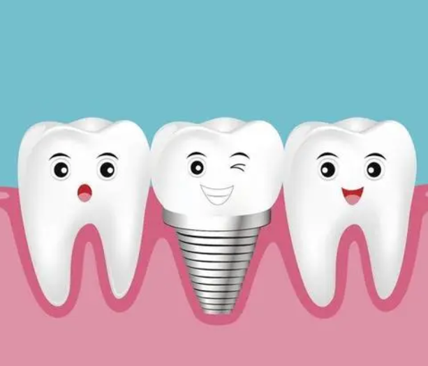 牙齒缺失咗，三種修復手段，邊種會比較好？