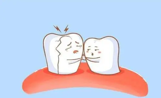 點解牙齒突然敏感疼痛但又睇唔到蛀牙？