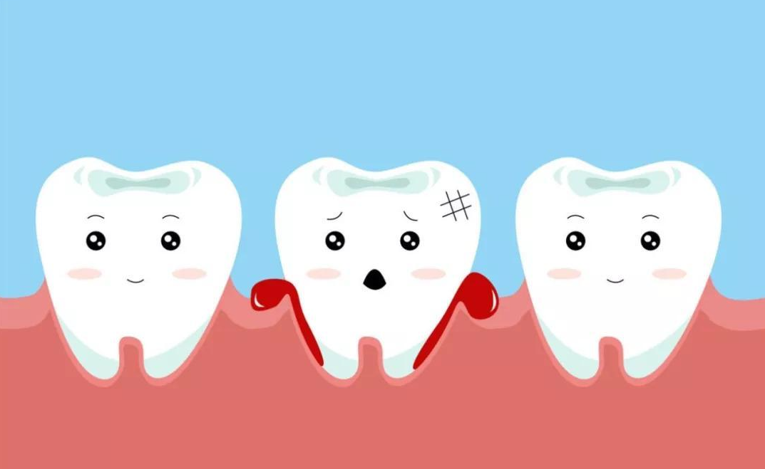 牙齒好地地，點解用力一吸牙龈就出血？