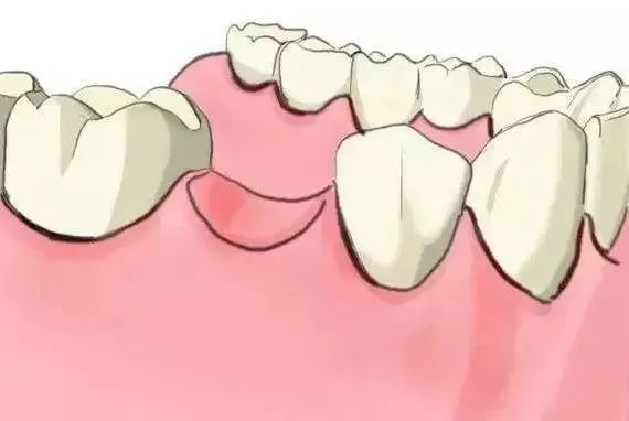 牙齒健康嘅四個標準，你知道咩？