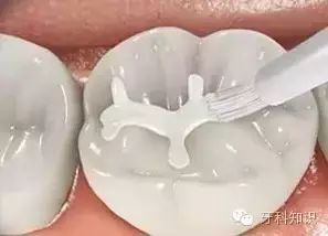 一顆壞牙如何帶“壞”全身？