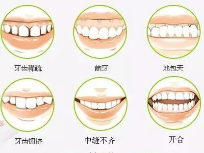 牙齒需要矯正嘅情況