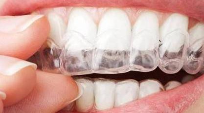 隱形箍牙會傷害牙齒嗎？