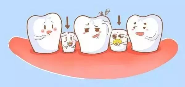 兒童換牙期常見的四個問題！