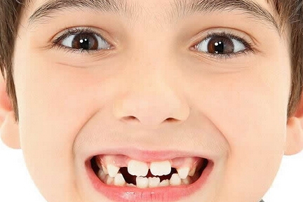 吃手、磨牙的壞習慣，對孩子的牙齒有什麼影響？