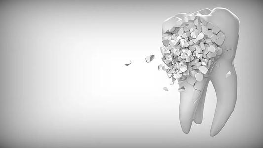 維港齒科中心——不容小覷的牙周炎