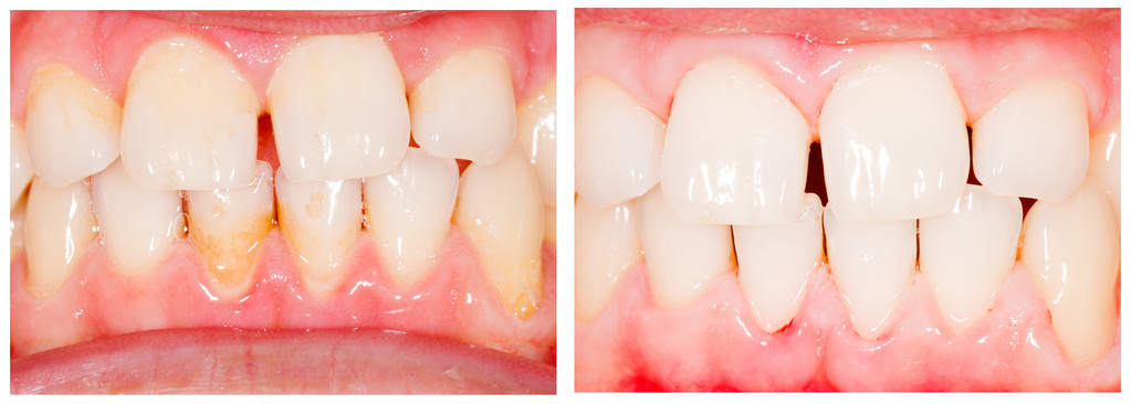 知道這九大原理，牙齒患病率降低95%！