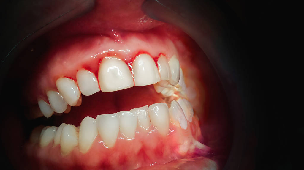 到了一定年齡段，牙齒鬆動怎麼辦？