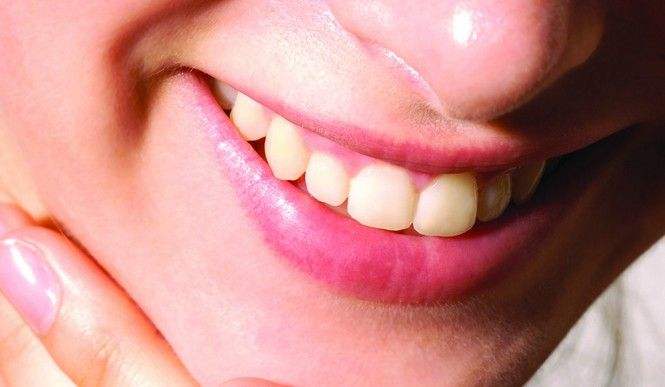 齙牙會遺傳