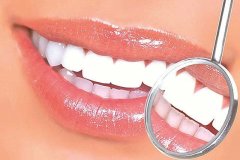 洗牙頻率多久一次合適？