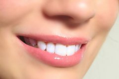 半口種牙時間需要多長？