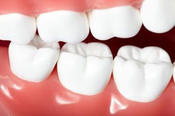 杜牙根牙齒疾病