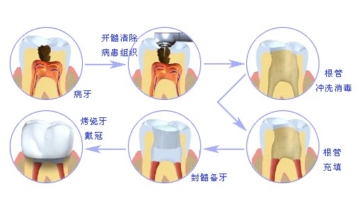 深圳杜牙根費用幾多？