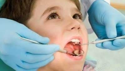 兒童蛀牙嚴重要補牙嗎？