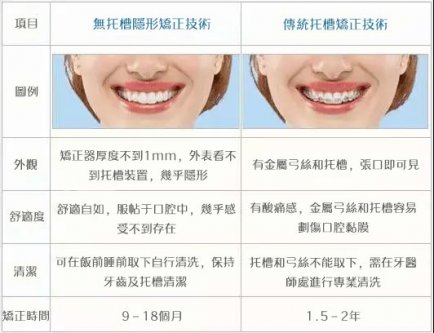 隱形cool牙同傳統cool牙邊個好