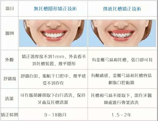 深圳隱形cool牙,深圳傳統cool牙