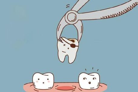 拔牙後幾時可以鑲牙？