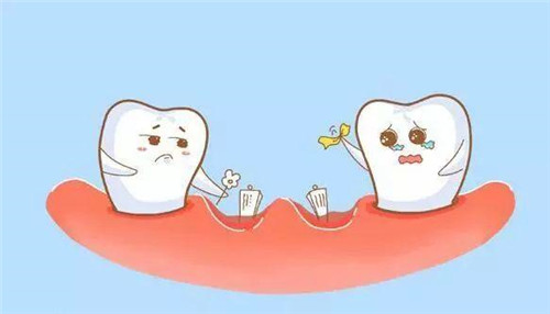 缺牙誤區