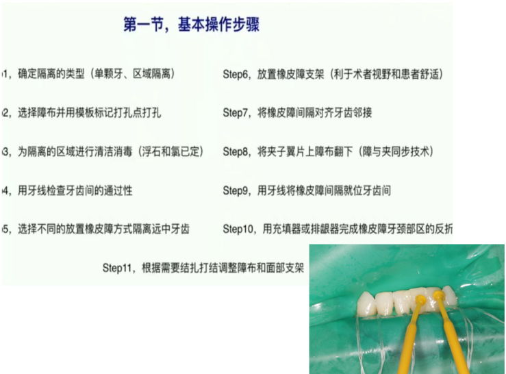 大陸根管治療價錢